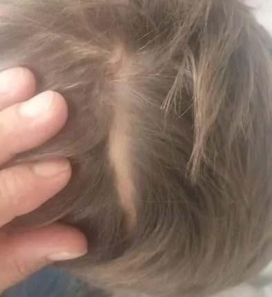 <p>Baba Serhat &Ccedil;etin, "İnsan canını hi&ccedil;e sayabilecek kadar k&ouml;r olmamalıyız diye d&uuml;ş&uuml;n&uuml;yorum. Mevzu sadece benim &ccedil;ocuğum değil; o g&uuml;nden bu g&uuml;ne kadar sayısız saldırı haberi okudum. K&ouml;pek saldırısı y&uuml;z&uuml;nden &ouml;len ve yaralanan insanlar oldu. Bug&uuml;n hala biz o g&uuml;n&uuml;n izlerini ve psikolojik rahatsızlıklarını yaşıyoruz maalesef. Oğlum Yağız, bir kediyi bile sevemeyecek durumda maalesef."</p>

<p>&nbsp;</p>
