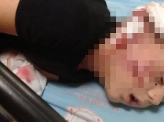 <p><span style="color:#B22222"><strong>GECE YATAKTA SI&Ccedil;RIYOR</strong></span></p>

<p>&nbsp;</p>
