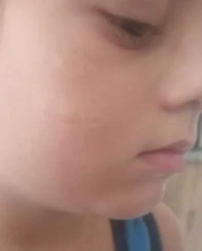 <p>Baba Serhat &Ccedil;etin oğlu Yağız'ın yaşadığı k&ouml;pek saldırının ardından sahibine k&ouml;peği başı boş olarak sokağa bıraktığı i&ccedil;in Antalya 26'ıncı Asliye Ceza Mahkemesi'nde dava a&ccedil;tığını s&ouml;yledi.</p>

<p>&nbsp;</p>
