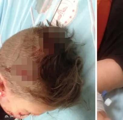 <p>Yargılama sonunda bu kişinin 10 ay hapis cezası aldığını da belirten baba &Ccedil;etin, "Bu cezanın 2 bin 400 TL para cezasına &ccedil;evrildi. Benim oğlumun &ccedil;ektiği a&ccedil;ıyı ben bilirim. Y&uuml;z&uuml;nde, kolunda ve başındaki ısırık izi kaldı. Bir kez daha s&ouml;yl&uuml;yorum sokalar ve parklar &ccedil;ocukların rahat y&uuml;r&uuml;yebileceği yerler olmalı. K&ouml;pek saldırısı korkusu ile parka gidilmez, sokağa &ccedil;ıkılmaz" diye konuştu.</p>

<p>&nbsp;</p>
