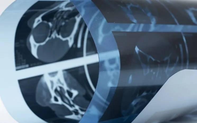 <p>Çocuk Cerrahisi Uzmanı Op. Dr. Mahmut Aluç tarafından gerçekleştirilen başarılı bir operasyonla, genç kızın sol yumurtalığında bulunan ve karaciğere kadar uzanan devasa kist içerisindeki 1.6 litre su boşaltılıp, başarıyla çıkarıldı.</p>