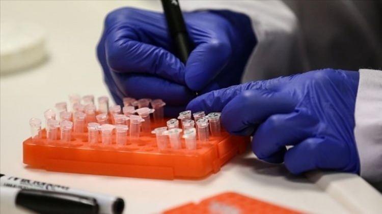 <p>ÇİÇEK AŞISI ETKİLİ Mİ?</p>
<p>Raporda, çiçek hastalığına karşı aşının rutin uygulandığı dönemde çiçek aşısıyla aşılananlarda, çiçek aşısının maymun çiçeğini önlemede yaklaşık yüzde 85 oranında etkili olduğu belirtildi. Bu nedenle daha önce çiçek aşısı olanların hastalığı daha hafif geçirebileceği ya da hastalıktan korunabileceği ifade edildi. "Çiçek hastalığına karşı önceden aşı yapıldığının göstergesi olarak ön kol üst kısmındaki aşı izi kabul edilebilir." denildi.</p>