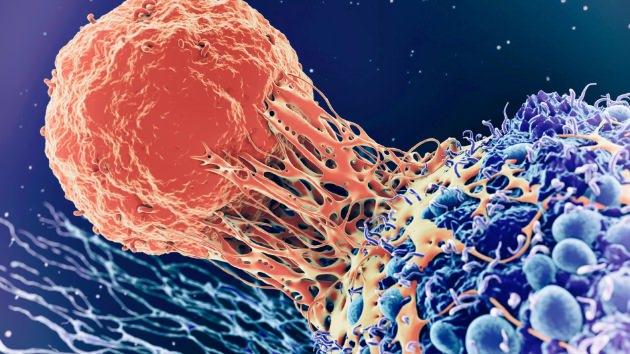 <p>Duke Üniversitesi'nden Dr. Nicholas DeVito, kırmızı et ve tütsülenmiş gıdaların kanser riskini artırdığını ve yeni hastalarının çoğunun 45 yaşının altında olduğunu ifade etti.</p>
<p> </p>