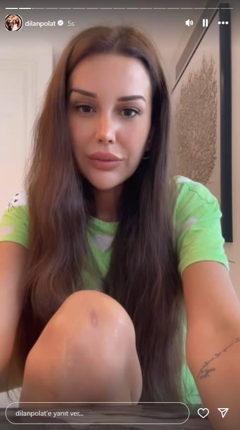 <p><span style="color:#B22222"><strong>"S&Uuml;REKLİ BAYILIYORDUM" DEDİ, BACAĞINDAKİ İZİ G&Ouml;STERDİ</strong></span></p>
