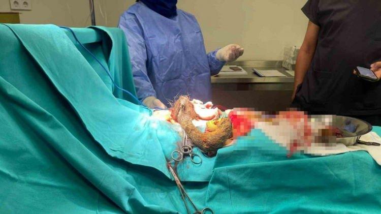 <p>Ardından Kayseri Şehir Hastanesi Çocuk Cerrahi Servisi'ne yönlendirilen kızı, Doç. Dr. Murat Kabaklıoğlu ameliyata aldı. Kızın midesindeki ve on iki bağırsağındaki 3.5 kiloluk kıl yumağı, başarılı bir ameliyat ile çıkarıldı.</p>
<p> </p>