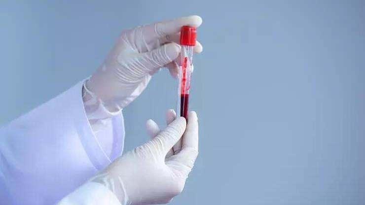 <p>Çalışmanın sonuçlarına göre, A grubuna ait genetik varyasyonu taşıyan kişilerin 60 yaşından önce felç geçirme riski, diğer kan gruplarına sahip kişilere kıyasla yüzde 16 daha yüksek. </p>
<p> </p>
