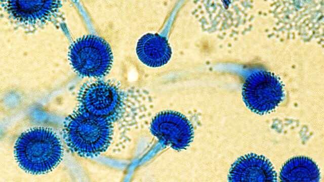 <p>Özellikle “<strong>Aspergillus fumigatus</strong>” adlı mantarın, bağışıklık sistemi zayıf olan bireylerde <strong>akciğer enfeksiyonlarına</strong> yol açabileceği uyarısı yapılmaktadır.</p>