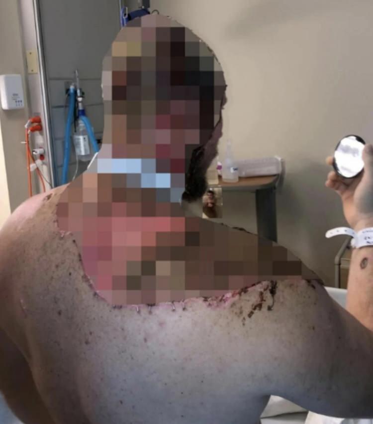<p>Tedavi süreci boyunca iki kez kalbi duran Pendleton’ın şu an kafatasında bir delik olduğu için koruyucu bir şapka taktığı ve beynini başının bir noktasında hissedebildiği belirtiliyor.</p>

<p> </p>
