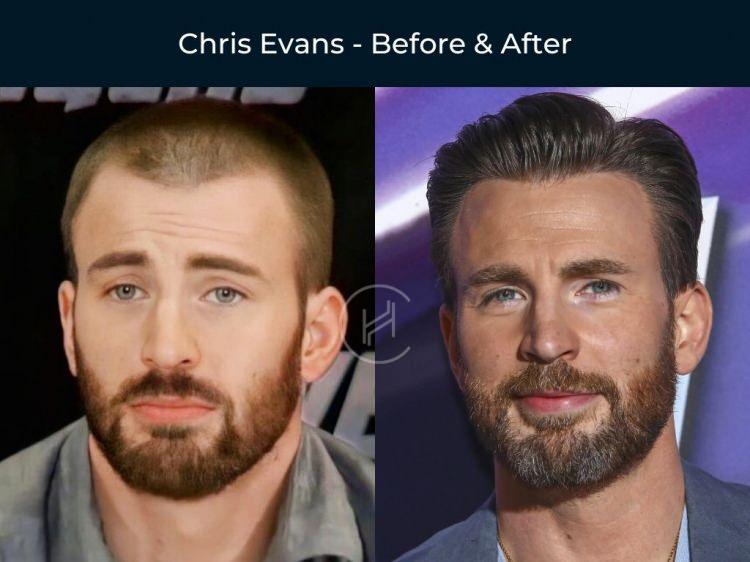 <p><strong><span style="color:#B22222">CHRIS EVANS </span></strong></p>
<p> </p>