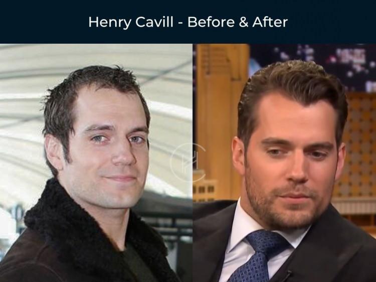 <p><strong><span style="color:#B22222">HENRY CAVILL</span></strong></p>

<p> </p>

