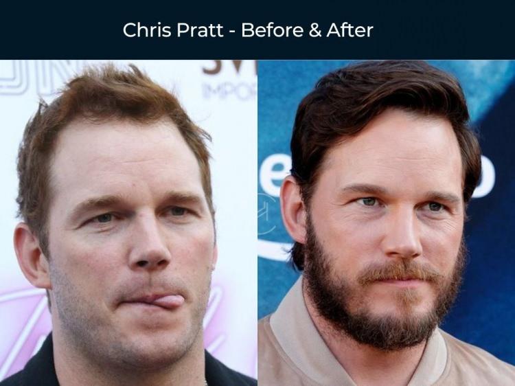 <p><strong><span style="color:#B22222">CHRIS PRATT</span></strong></p>

<p>&nbsp;</p>
