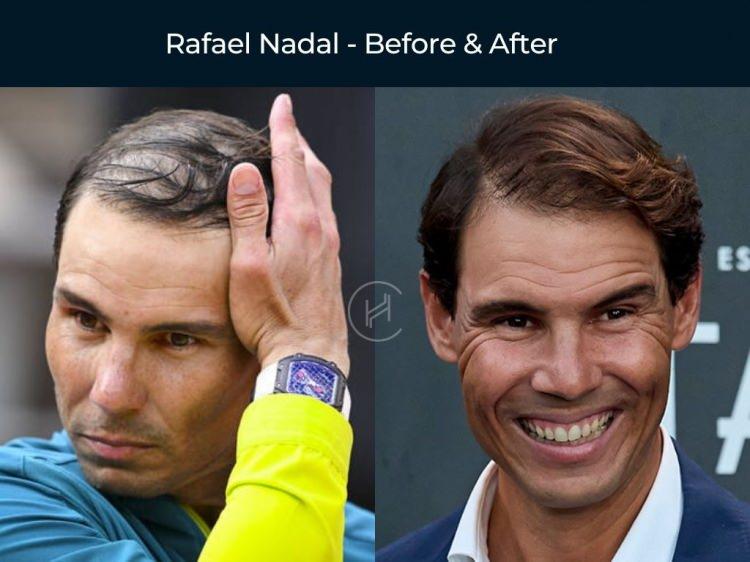 <p><strong><span style="color:#B22222">RAFAEL NADAL</span></strong></p>

<p> </p>
