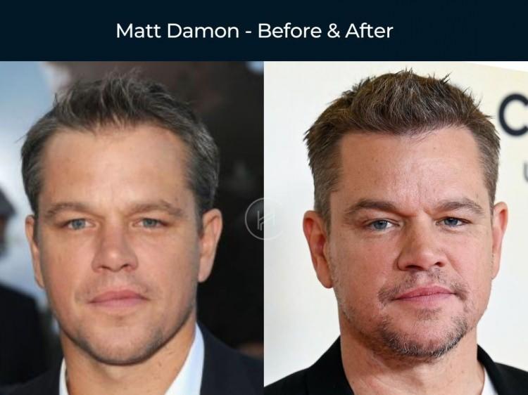 <p><strong><span style="color:#B22222">MATT DAMON</span></strong></p>
<p> </p>