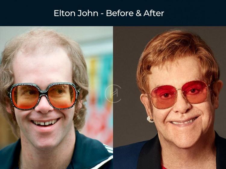 <p><strong><span style="color:#B22222">ELTON JOHN</span></strong></p>

<p> </p>
