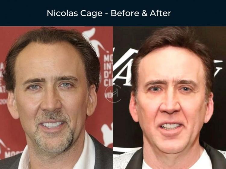 <p><strong><span style="color:#B22222">NICOLAS CAGE</span></strong></p>
<p> </p>
