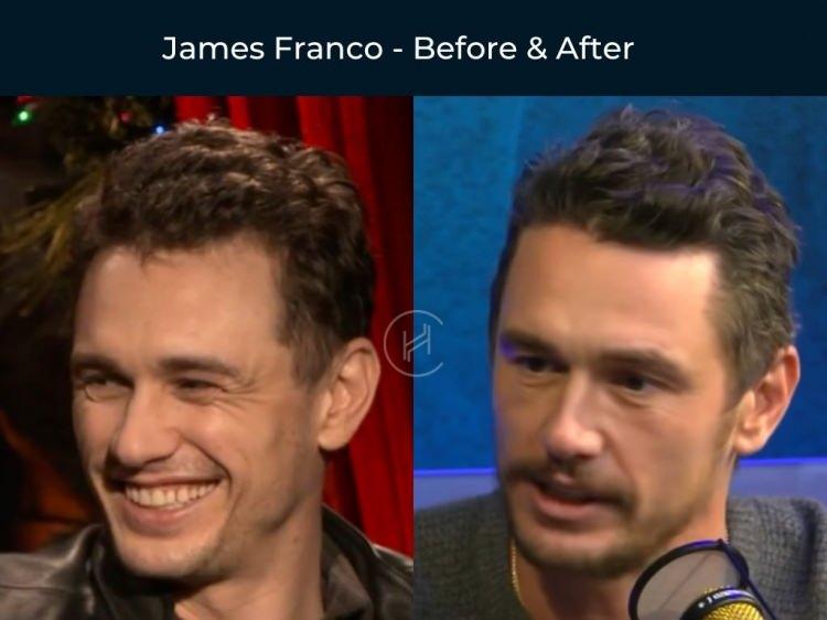 <p><span style="color:#B22222"><strong>JAMES FRANCO</strong></span></p>
<p> </p>