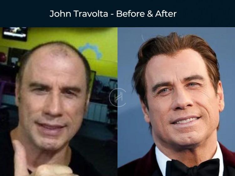<p><strong><span style="color:#B22222">JOHN TRAVOLTA</span></strong></p>
<p> </p>
