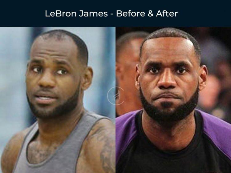 <p><strong><span style="color:#B22222">LEBRON JAMES</span></strong></p>
<p> </p>