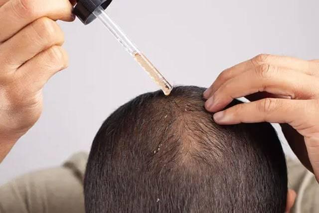 <p><strong>SAÇ DÖKÜLMESİNİ DURDURAN DOĞAL SERUM TARİFİ</strong></p>