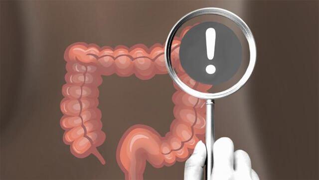 <p><strong>7- Kolonoskopi ve Tarama Testlerini Unutmayın</strong></p>
