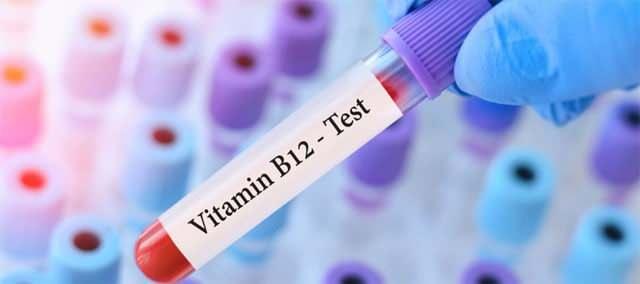 <p>Sonuç olarak, <strong>B12 vitamini</strong> sağlığımız ve kaliteli bir yaşam için büyük önem taşır. <strong>B12 vitamini eksikliği</strong>, vücudun çeşitli sistemlerini derinden etkiler ve erken teşhis edilip tedavi edilmediğinde kalıcı hasarlara yol açabilir. Bu nedenle, <strong>B12 eksikliğinin en sinsi belirtilerine dikkat etmeli</strong> ve sağlığınızı korumak için gerekli önlemleri almalısınız.</p>