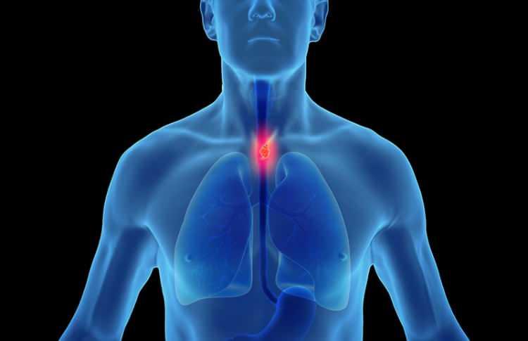<p><strong>Endokrin (iç salgı bezi), beslenme ve metabolizmayla ilgili hastalıklar</strong> 22175 Kişi</p>
<p><strong>Lenfoid ve hematopoetik kötü huylu tümörü</strong> 6113 Kişi</p>
<p><strong>Cerviks uterinin (uterus boyunun) kötü huylu tümörü </strong>516 Kişi</p>