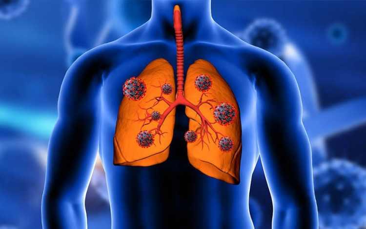 <p><strong>Genitoüriner sistem hastalıkları</strong> 18909 Kişi</p>
<p><strong>Böbrek ve üreter hastalıkları</strong> 16666 Kişi</p>
<p><strong>Glomerüler ve renal tübülo-interstisyel hastalıklar </strong>134 Kişi</p>
<p><strong>Böbrek yetmezliği</strong> 16469 Kişi</p>
<p><strong>Prostat hiperplazisi</strong> 170 Kişi</p>
<p><strong>Kadın pelvik organların iltihabi hastalıkları</strong> 10 Kişi</p>
