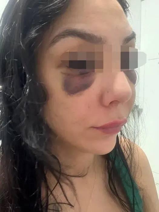 <p>F.H., müşteriden kıskandığı iş arkadaşı A.T.S.'yi iş yerinin tuvaletinde feci şekilde darp etti. </p>