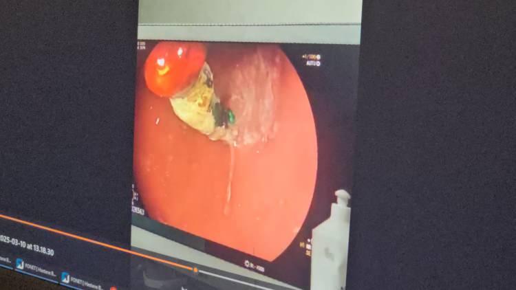 <p>Aileleri de uyaran Dr Özkaya, özellikle küçük çocukları olan ailelerin bu gibi oyuncakları evlerinden uzak tutmaları tavsiyesinde bulundu.</p>