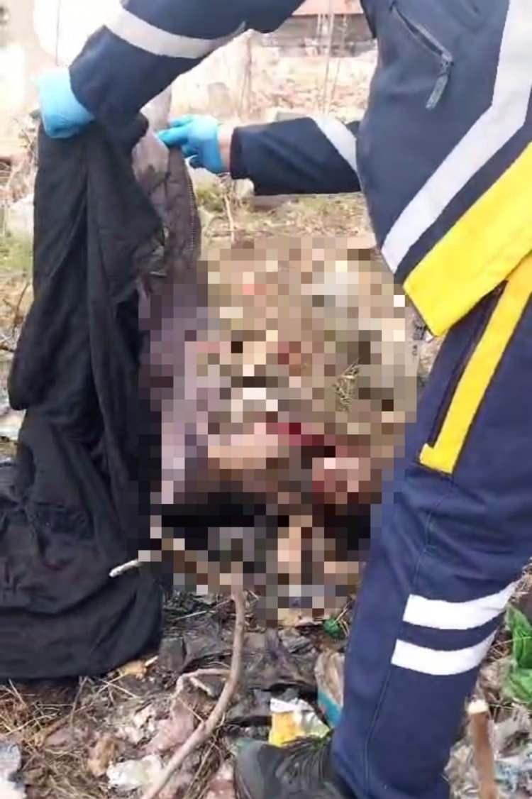 <p>Kızının yakılarak öldürüldüğünü ileri süren baba İbrahim Elmuhammed, <strong><em>"Kızım kardeşi ile bakkala gitmişti. Eve geldikten sonra tekrar gitti ama bu kez geri gelmedi. Bir süre sonra annesi komşularımızla birlikte aramaya çıktı ama bulamadı. Metruk binadaki bir kişi ilk başta eşimin içeri girmesine izin vermemiş. Ardından iki kez ablam gelmiş ona da müsaade etmemiş. Daha sonra annem o adama, kızımı görüp görmediğini sorunca, ‘Kulaklarım duymuyor' diye cevap vermiş ama normalde duyuyordu, bir problemi yoktu. Annem ve eşim o sırada yerde kızımın montunu görmüş. Daha sonra da diğer elbiseleri ile karşılaşmışlar. Üzerini naylonla örtüp yakmaya çalışmışlar kızımı. Anladığım kadarıyla kızım öldükten sonra cesedini buraya getirmişler. Vücudunda köpek ısırıkları var ama o köpek kızımın elbiselerini nasıl çıkarmış olabilir. Çocuğumun üzerinde hiç kıyafet yoktu. Bir sebep olduğunu düşünüyorum ve şüphelendiğim birileri var ama insanlara da iftira atmak istemiyorum"</em></strong> dedi.</p>
