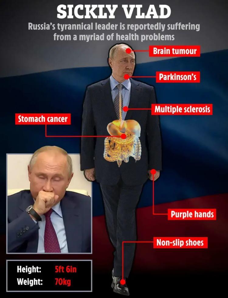 <p>Birçok kez topallayarak yürürken de görülmüştü.</p>
<p><br />
Kanser ve Parkinson hastası olabileceğine dair iddialar da var. </p>
<p><br />
Zelenskiy ayrıca dün geceki röportajında Putin'in Macaristan gibi daha Rus dostu üyelere atıfta bulunarak 'Avrupa Birliği'ni içeriden vurmaya çalıştığını' iddia etti.</p>
<p> </p>