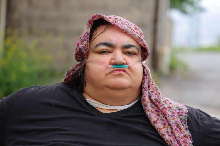 <p>Kahramanmaraş'ta yaşayan ve aşırı kilo problemiyle mücadele eden Fatma Dağlı (48), <strong>"Benim hayatım çok zor ve çok kötü. Aylarca evden dışarı çıkmamıştım. Sabah sürüyerek indirdi 5-6 kişi."</strong> diyerek, yaşadığı zorlukları anlattı.</p>