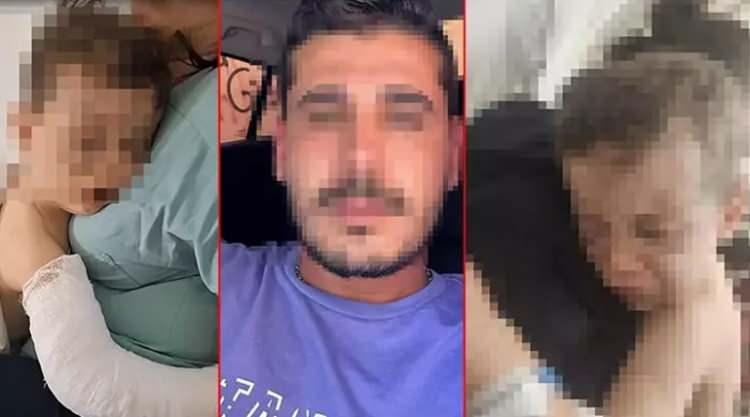 <p>Burada yapılan tetkiklerde; çocuğun sağ kolunda kırık olduğu, vücudunun birçok yerinde darp izleri bulunduğu ve göz çevresindeki şiddetli travmalar nedeniyle sağ gözünü kaybetme riski taşıdığı belirlendi. </p>