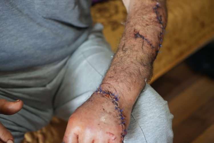 <p>Akşam saatlerinde, birlikte çay içtikten kısa bir süre sonra uyumaya hazırlanan Necdet Tilif, iddiasına göre uykudayken eşi tarafından çok sayıda bıçak darbesiyle yaralandı. </p>