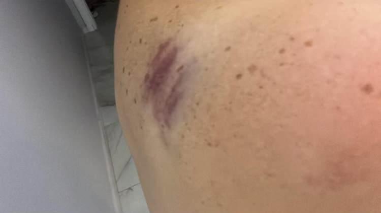 <p>İki çocuk annesi Meryem G., eşine uzaklaştırma kararı aldırdı.</p>