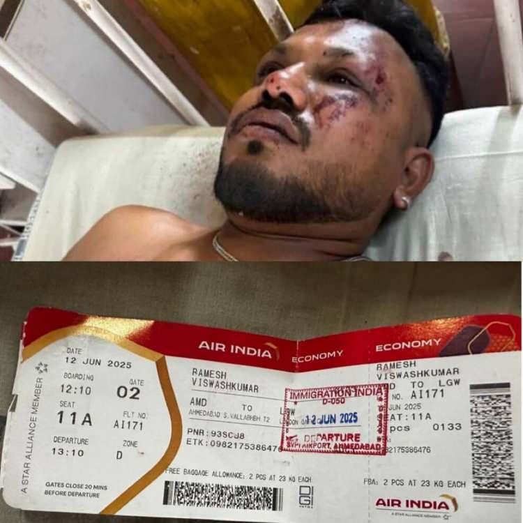 <p>11A numaralı koltukta oturan Vishwashkumar Ramesh, kazanın olduğu bölgeden yürüyerek uzaklaştı ve ambulansa kendi bindi.</p>

<p> </p>
