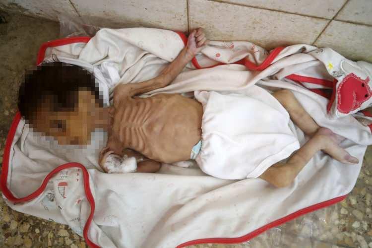 <p>İsrail'in 2 Mart'tan bu yana yardım girişine izin vermediği Gazze Şeridi'nin orta kesiminde yer alan Deyr el-Belah kentinde, 3 aylık kız bebek Curi el-Mısri yetersiz beslenme nedeniyle yaşamını yitirdi.</p>
<p>Sağlıklı bir şekilde dünyaya gelen minik Curi, İsrail'in Gazze'de uyguladığı sıkı ablukanın son kurbanı oldu ve dün hayatlarını kaybeden 5 aylık Nidal ile 10 günlük Kinda gibi açlıktan ölenlerin kervanına katıldı.</p>