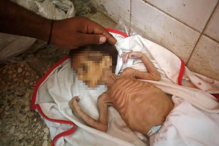 <p>Gazze'den ve uluslararası camiadan yapılan tüm bu uyarılara ve yardım çağrılarına rağmen dün Nasır Hastanesinde 5 aylık Nidal ile 10 günlük Kinda bebek daha hayatını kaybetmişti.</p>