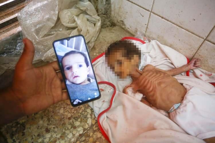 <p><strong>"ÇOCUKLARIN AÇLIKTAN ÖLMESİ EN ÇİRKİN SAVAŞ SUÇU"</strong></p>
<p>Uluslararası topluma seslenen acılı baba, "Kızım açlıktan ve hiçbir suçu yokken öldü. Uluslararası toplumdan bu çocuklara bir çıkış yolu bulmasını istiyorum." dedi.</p>
<p>İsrail saldırılarının ne çocuklara, ne de yaşlılara acıdığını kaydeden Muhsin, "Bu savaşın gayesi nedir anlamış değiliz. Bu çocuklar hiçbir suçları yokken öldürülüyor. Bu en çirkin savaş suçu." ifadesini kullandı.</p>