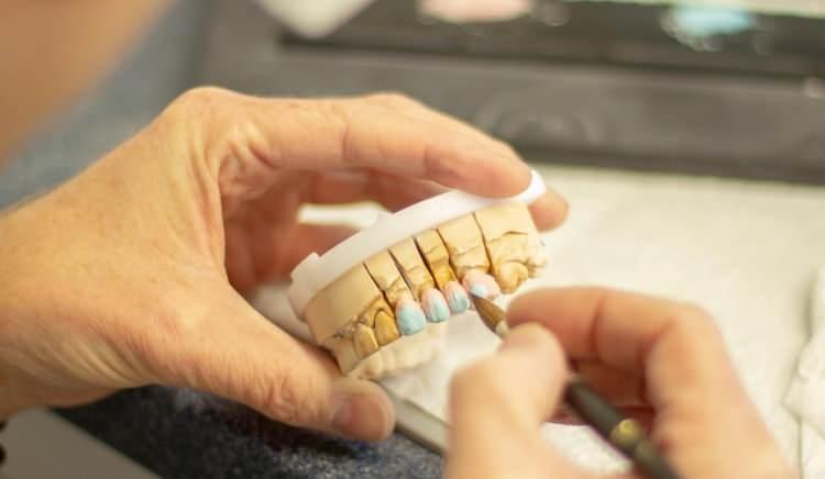 <p><span style="color:#800000"><strong>BİNLERCE DOLAR KAZANÇ SAĞLADILAR</strong></span></p>
<p><span style="color:#000000">Ruhsatsız klinikte çalışan 44 yaşındaki diğer zanlının ise hastalar için diş protezleri ürettiği belirtildi.</span></p>
<p><span style="color:#000000">İnsanların sağlığını riske atarak ev ortamında hizmet veren sahte diş hekimlerinin, yasa dışı klinikte 4 milyon Çek kronu (yaklaşık 185 bin dolar) kazanç sağladığı da öğrenildi.</span></p>
