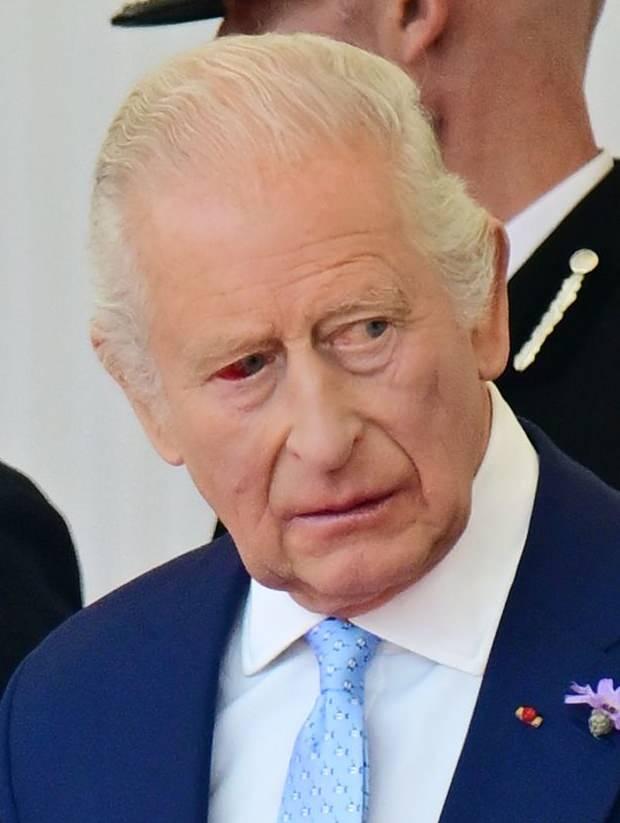 <p><span style="color:#000000"><strong>Uzun zamandır kanserle mücadele eden Kral Charles'ın kötü durumda görünen göz çevresi, 'Charles'ın durumu ağırlaştı mı?' sorusunu gündeme getirdi. Konuya dair Buckingham Sarayı'ndan açıklama gelmedi.</strong></span></p>