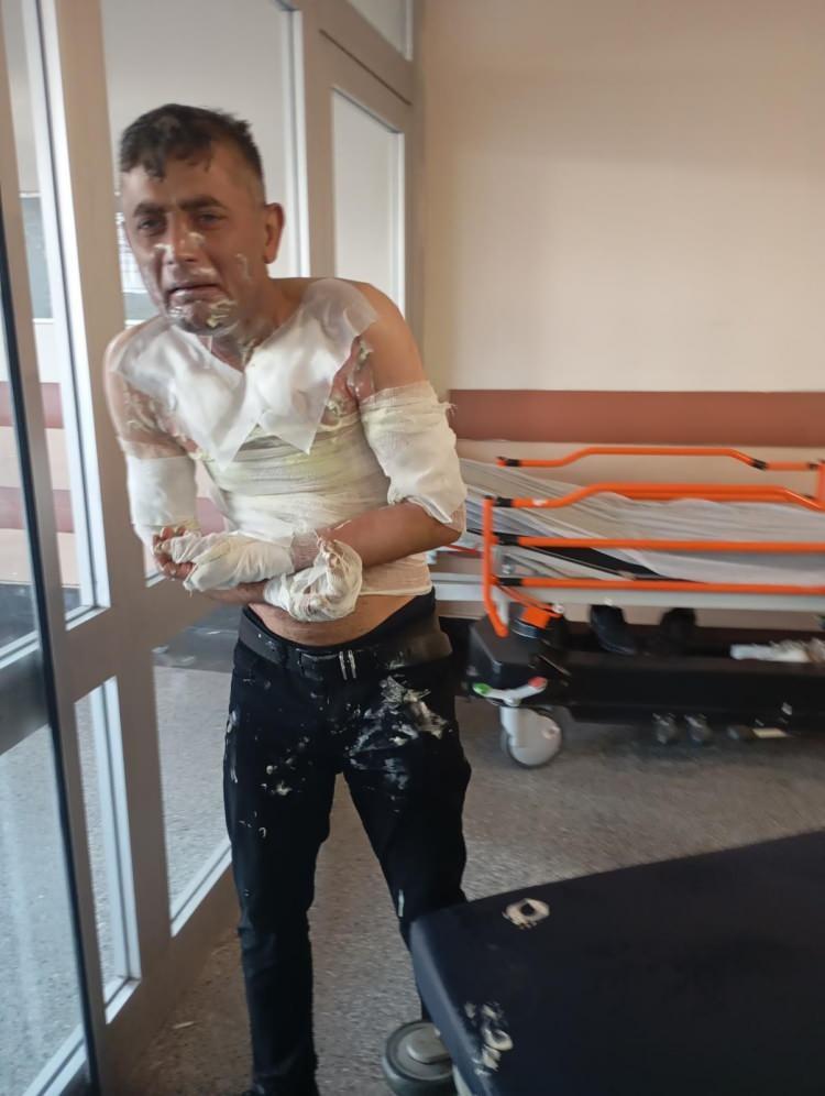 <p>Vücudunun büyük bir bölümü yanan Ahmet Sanduvaç, yarı çıplak bir şekilde evine geldi. Şok olan aile, Sanduvaç'ı Bağcılar Eğitim ve Araştırma Hastanesi'ne götürdü. </p>