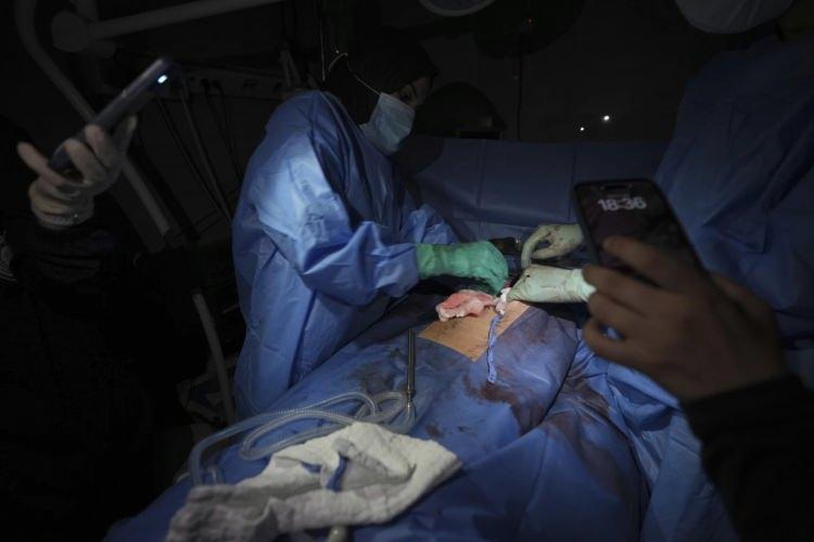 <p>Doktorlar ve hemşireler, elektrik, su ve temiz medikal malzemeler olmadan zorlu koşullarda hastalara müdahale ediyor. Sağlık ekipleri Gazze’de devam eden elektrik kesintisi sebebiyle ameliyatları telefon ışıklarıyla yapıyorlar.</p>