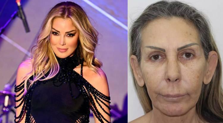 Petek Dinçöz'ün annesi estetik yaptırdı! Resmen tanınmaz halde