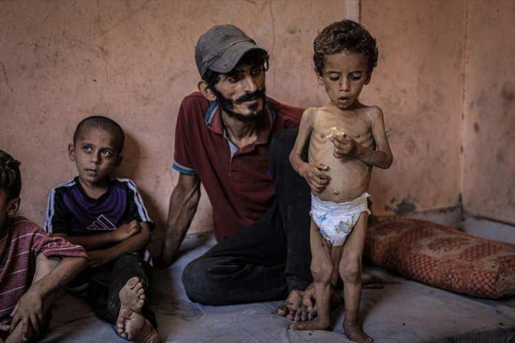 <p>6 BİN ÇOCUĞA YETERSİZ BESLENME TEŞHİSİ</p>
<p>Birleşmiş Milletler Çocuklara Yardım Fonu (UNICEF), haziranda İsrail saldırıları altındaki Gazze Şeridi’nde yaklaşık 6 bin Filistinli çocuğa yetersiz beslenme teşhisi konulduğunu duyurdu.</p>