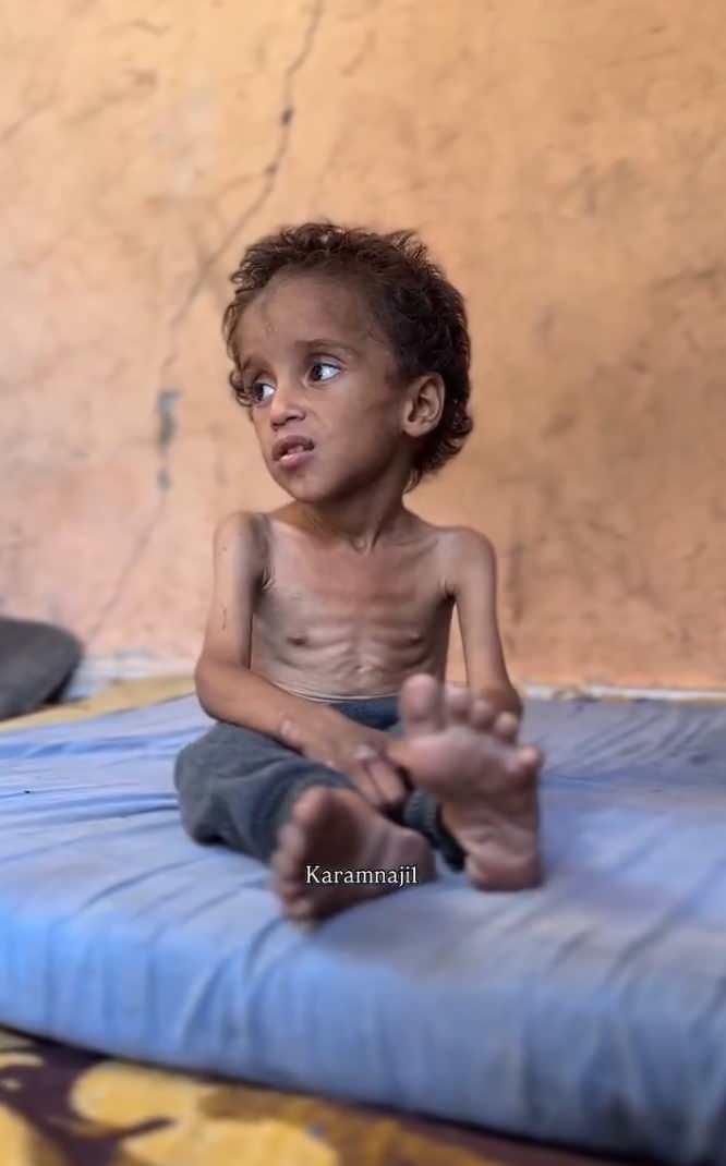 <p>UNRWA İletişim Direktörü Juliette Touma da basına verdiği röportajda, bir kaç kilometre ötede dükkanların dolu olmasına karşın Gazze'de aralarında BM çalışanlarının da olduğu bütün halkın kıtlık yaşadığını ve şiddetli açlıktan bayıldığını söyledi.</p>
