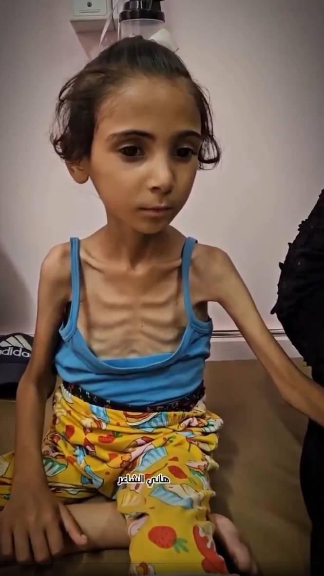 <p>Tel Aviv yönetimi, 6 bin tır insani yardımın girişine izin vermiyor.</p>
