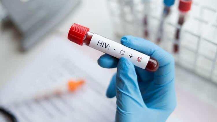 <p><span style="color:#B22222"><strong>AIDS</strong></span></p>
