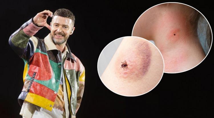 <p><span style="color:#B22222"><em><strong>90'lı yıllardan beri sayısız hit parçayla müzik listelerini altüst eden dünyaca ünlü yıldız Justin Timberlake, 2 yıldır yoğun turne süreciyle gündemdeydi. Konser temposunu tamamlayan 44 yaşındaki sanatçı, bugüne kadar gizlediği hastalığını ilk kez açıkladı.</strong></em></span></p>