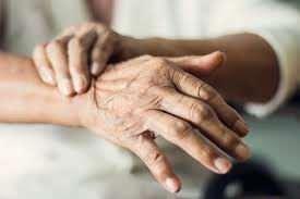 <p><strong>Parkinson</strong></p>

<p> </p>
